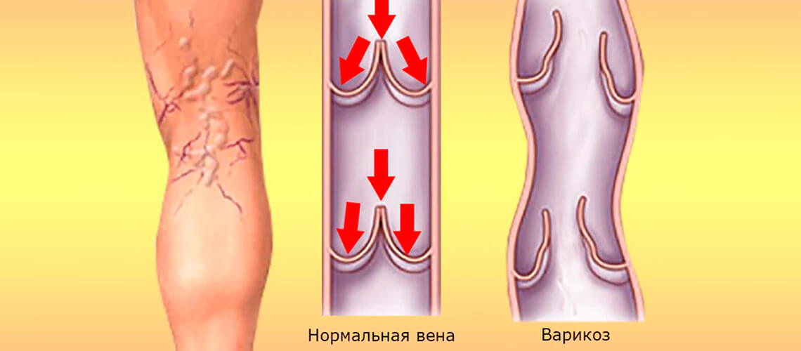 болезни 3